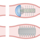 Illustration for article titled Want the Best Medical Care? Swallow This Pill Covered in Tiny Needles.